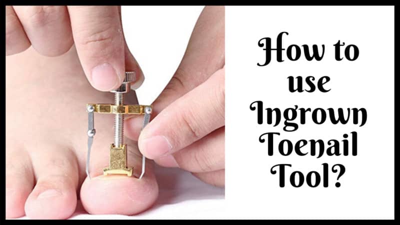 How to use Ingrown Toenail Tool?