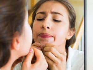 How to shrink a cystic pimple