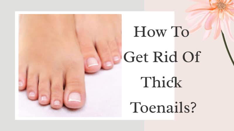 How To Get Rid Of Thick Toenails?